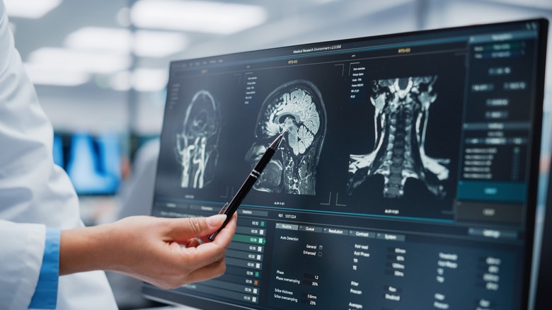 inspecting a patient's mri